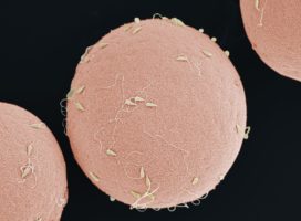 Al microscopio-elettronico spermatozoi sulla superficie di un uovo di riccio di mare non fecondato